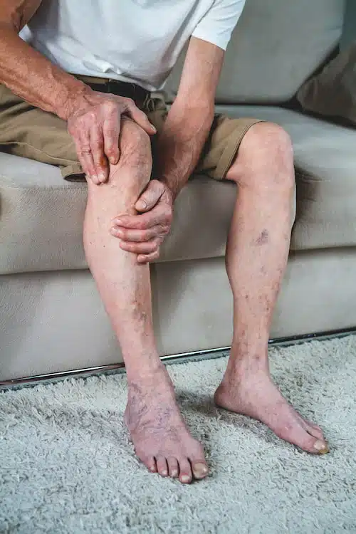 Facet joint arthritis experienced by an aelderly man while sitting on couch